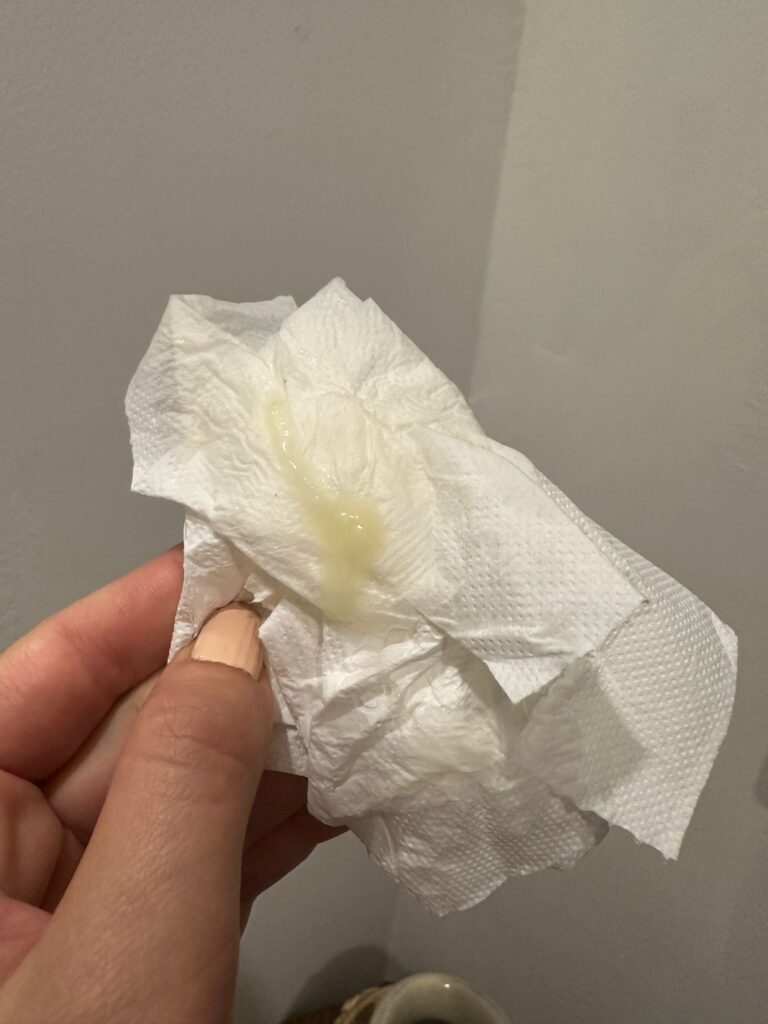 exemple photo bouchon muqueux